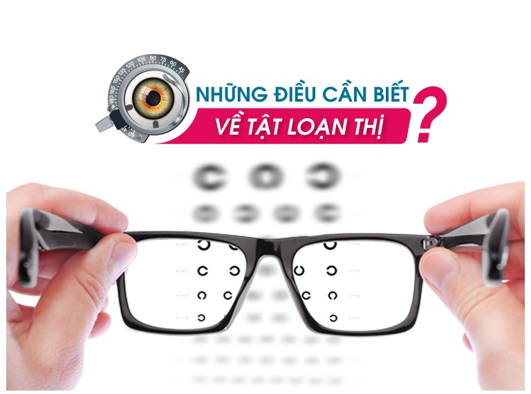 Những điều cần biết về tật loạn thị?