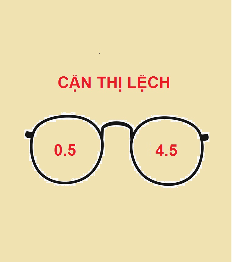 𝗖𝗔̣̂𝗡 𝗧𝗛𝗜̣ 𝗟𝗘̣̂𝗖𝗛 - 𝗡𝗚𝗨𝗬 𝗛𝗜𝗘̂̉𝗠 𝗧𝗛𝗘̂́ 𝗡𝗔̀𝗢